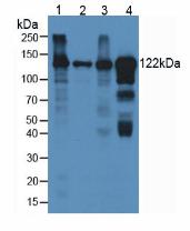 CP / Ceruloplasmin Antibody - Western Blot