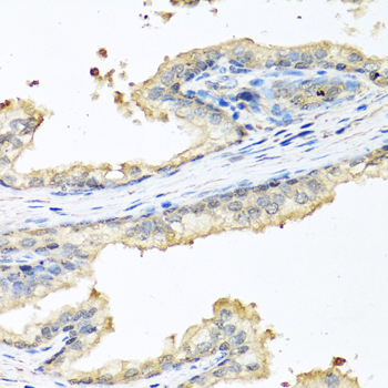 CP / Ceruloplasmin Antibody - Immunohistochemistry of paraffin-embedded human prostate.