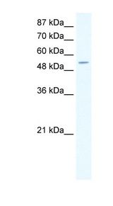 CPA1 / Carboxypeptidase A Antibody - CPA1 antibody Western blot of HepG2 cell lysate. This image was taken for the unconjugated form of this product. Other forms have not been tested.
