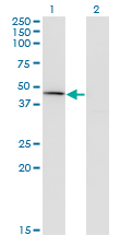 CPA1 / Carboxypeptidase A Antibody - Western Blot analysis of CPA1 expression in transfected 293T cell line by CPA1 monoclonal antibody (M01), clone 3F11.Lane 1: CPA1 transfected lysate(47.1 KDa).Lane 2: Non-transfected lysate.