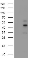 CPA1 / Carboxypeptidase A Antibody - HEK293T cells were transfected with the pCMV6-ENTRY control (Left lane) or pCMV6-ENTRY CPA1 (Right lane) cDNA for 48 hrs and lysed. Equivalent amounts of cell lysates (5 ug per lane) were separated by SDS-PAGE and immunoblotted with anti-CPA1.