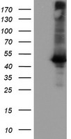 CPA1 / Carboxypeptidase A Antibody - HEK293T cells were transfected with the pCMV6-ENTRY control (Left lane) or pCMV6-ENTRY CPA1 (Right lane) cDNA for 48 hrs and lysed. Equivalent amounts of cell lysates (5 ug per lane) were separated by SDS-PAGE and immunoblotted with anti-CPA1.