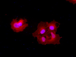 CPA1 / Carboxypeptidase A Antibody - Anti-CPA1 mouse monoclonal antibody  immunofluorescent staining  (Red) of COS7 cells transiently transfected by pCMV6-ENTRY CPA1.