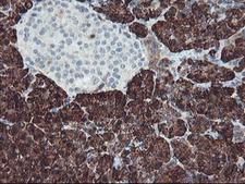 CPA1 / Carboxypeptidase A Antibody - IHC of paraffin-embedded Human pancreas tissue using anti-CPA1 mouse monoclonal antibody.