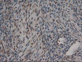 CPA1 / Carboxypeptidase A Antibody - IHC of paraffin-embedded ovary using anti-CPA1 mouse monoclonal antibody.