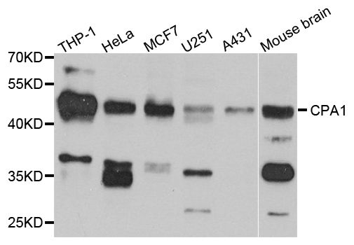 CPA1 / Carboxypeptidase A Antibody - Western blot analysis of extracts of various cell lines, using CPA1 antibody at 1:1000 dilution. The secondary antibody used was an HRP Goat Anti-Rabbit IgG (H+L) at 1:10000 dilution. Lysates were loaded 25ug per lane and 3% nonfat dry milk in TBST was used for blocking. An ECL Kit was used for detection and the exposure time was 90s.