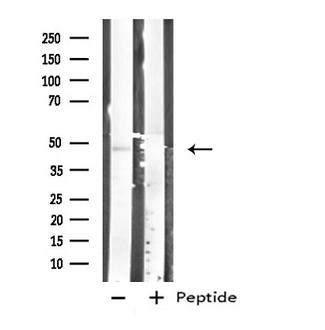 CPA1 / Carboxypeptidase A Antibody - Western blot analysis of extracts of K562 cells using CARBOXYPEPTIDASE A1 antibody.