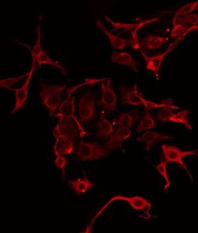 CPA1 / Carboxypeptidase A Antibody - Staining HeLa cells by IF/ICC. The samples were fixed with PFA and permeabilized in 0.1% Triton X-100, then blocked in 10% serum for 45 min at 25°C. The primary antibody was diluted at 1:200 and incubated with the sample for 1 hour at 37°C. An Alexa Fluor 594 conjugated goat anti-rabbit IgG (H+L) Ab, diluted at 1/600, was used as the secondary antibody.