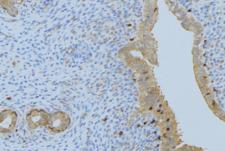 CPA1 / Carboxypeptidase A Antibody - 1:100 staining human uterus tissue by IHC-P. The sample was formaldehyde fixed and a heat mediated antigen retrieval step in citrate buffer was performed. The sample was then blocked and incubated with the antibody for 1.5 hours at 22°C. An HRP conjugated goat anti-rabbit antibody was used as the secondary.