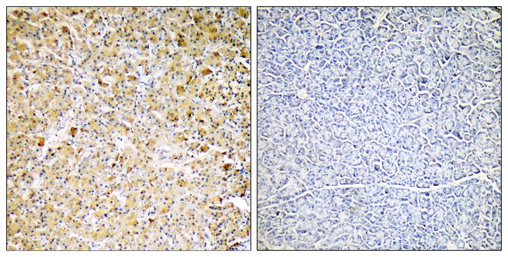 CPA1 / Carboxypeptidase A Antibody - Peptide - + Immunohistochemistry analysis of paraffin-embedded human pancreas tissue using CARBOXYPEPTIDASE A1 antibody.