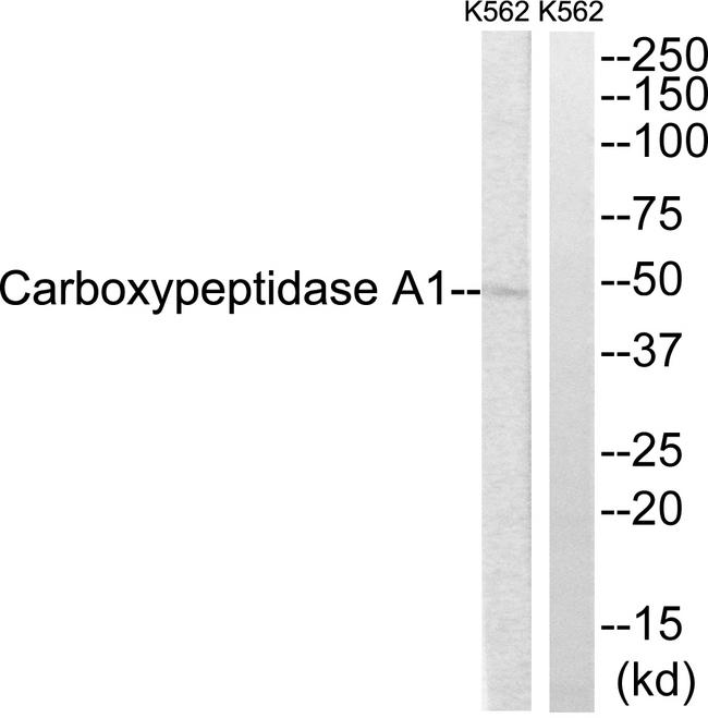 CPA1 / Carboxypeptidase A Antibody - Western blot analysis of extracts from K562 cells, using CARBOXYPEPTIDASE A1 antibody.