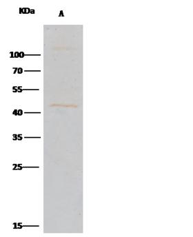 CPA1 / Carboxypeptidase A Antibody - CPA1 was immunoprecipitated using: Lane A: 0.5 mg Jurkat Whole Cell Lysate. 2 uL anti-CPA1 rabbit polyclonal antibody and 15 ul of 50% Protein G agarose. Primary antibody: Anti-CPA1 rabbit polyclonal antibody, at 1:200 dilution. Secondary antibody: Clean-Blot IP Detection Reagent (HRP) at 1:1000 dilution. Developed using the DAB staining technique. Performed under reducing conditions. Predicted band size: 50 kDa. Observed band size: 50 kDa.