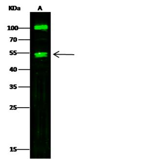 CPA1 / Carboxypeptidase A Antibody - Anti-CPA1 rabbit polyclonal antibody at 1:500 dilution. Lane A: Jurkat Whole Cell Lysate. Lysates/proteins at 60 ug per lane. Secondary: Goat Anti-Rabbit IgG H&L (Dylight800) at 1/10000 dilution. Developed using the Odyssey technique. Performed under reducing conditions. Predicted band size: 55 kDa. Observed band size: 47 kDa. (We are unsure as to the identity of these extra bands.)