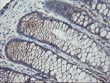 CPA2 Antibody - IHC of paraffin-embedded Human colon tissue using anti-CPA2 mouse monoclonal antibody.