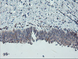 CPA2 Antibody - IHC of paraffin-embedded Human bladder tissue using anti-CPA2 mouse monoclonal antibody.