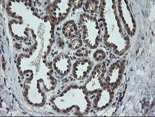 CPA2 Antibody - IHC of paraffin-embedded Human breast tissue using anti-CPA2 mouse monoclonal antibody.