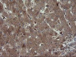 CPA2 Antibody - IHC of paraffin-embedded Human liver tissue using anti-CPA2 mouse monoclonal antibody.