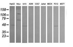 CPA2 Antibody - Western blot of extracts (35 ug) from 9 different cell lines by using g anti-CPA2 monoclonal antibody (HepG2: human; HeLa: human; SVT2: mouse; A549: human; COS7: monkey; Jurkat: human; MDCK: canine; PC12: rat; MCF7: human).