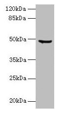 CPA2 Antibody - Western blot All lanes: CPA2 antibody at 8µg/ml + Jurkat whole cell lysate Secondary Goat polyclonal to rabbit IgG at 1/10000 dilution Predicted band size: 47 kDa Observed band size: 47 kDa