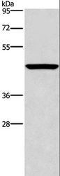CPA2 Antibody - Western blot analysis of Mouse pancreas tissue, using CPA2 Polyclonal Antibody at dilution of 1:500.