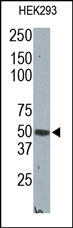 CPA2 Antibody - The Carboxypeptidase A2 Antibody is used in Western blot to detect Carboxypeptidase A2 in HEK293 cell lysate.