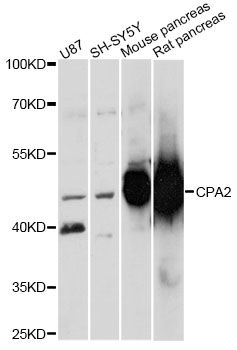 CPA2 Antibody - Western blot analysis of extracts of various cell lines, using CPA2 antibody at 1:3000 dilution. The secondary antibody used was an HRP Goat Anti-Rabbit IgG (H+L) at 1:10000 dilution. Lysates were loaded 25ug per lane and 3% nonfat dry milk in TBST was used for blocking. An ECL Kit was used for detection and the exposure time was 15s.