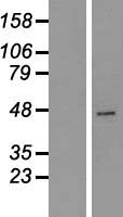 CPA2 Protein - Western validation with an anti-DDK antibody * L: Control HEK293 lysate R: Over-expression lysate
