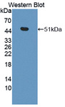 CPA3 Antibody - Western blot of CPA3 antibody.