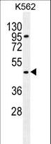 CPA3 Antibody - CPA3 Antibody western blot of K562 cell line lysates (35 ug/lane). The CPA3 antibody detected the CPA3 protein (arrow).