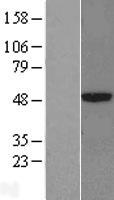 CPA3 Protein - Western validation with an anti-DDK antibody * L: Control HEK293 lysate R: Over-expression lysate