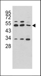 CPA4 Antibody - Western blot of CPA4 antibody in HeLa, CEM and NCI-H460 cell line lysates (35 ug/lane). CPA4 (arrow) was detected using the purified antibody.