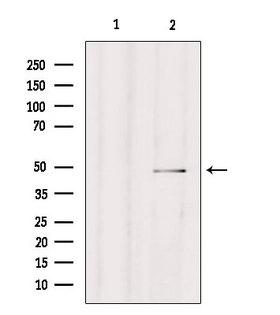 CPA4 Antibody - Western blot analysis of extracts of HepG2 cells using CPA4 antibody. Lane 1 was treated with the blocking peptide.