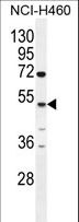 CPA6 / Carboxypeptidase A6 Antibody - CPA6 Antibody western blot of NCI-H460 cell line lysates (35 ug/lane). The CPA6 antibody detected the CPA6 protein (arrow).