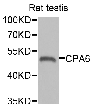 CPA6 / Carboxypeptidase A6 Antibody - Western blot analysis of extracts of rat testis.