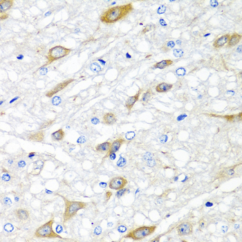 CPA6 / Carboxypeptidase A6 Antibody - Immunohistochemistry of paraffin-embedded rat brain tissue.