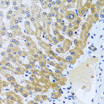 CPA6 / Carboxypeptidase A6 Antibody - Immunohistochemistry of paraffin-embedded human liver tissue.