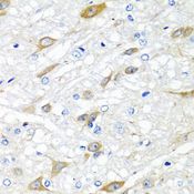CPA6 / Carboxypeptidase A6 Antibody - Immunohistochemistry of paraffin-embedded rat brain using CPA6 antibody at dilution of 1:100 (40x lens).