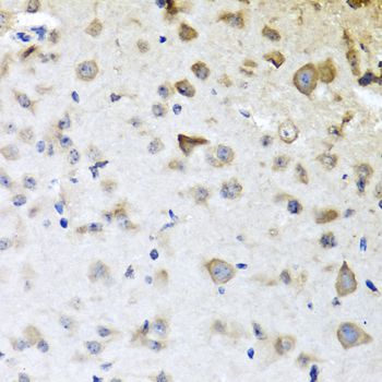 CPA6 / Carboxypeptidase A6 Antibody - Immunohistochemistry of paraffin-embedded mouse brain using CPA6 antibody at dilution of 1:100 (40x lens).