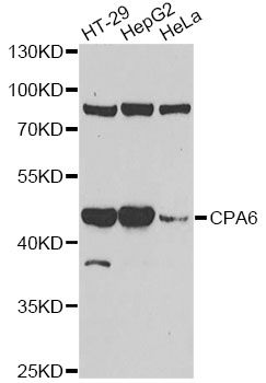 CPA6 / Carboxypeptidase A6 Antibody - Western blot analysis of extracts of various cell lines, using CPA6 antibody at 1:1000 dilution. The secondary antibody used was an HRP Goat Anti-Rabbit IgG (H+L) at 1:10000 dilution. Lysates were loaded 25ug per lane and 3% nonfat dry milk in TBST was used for blocking. An ECL Kit was used for detection and the exposure time was 90s.