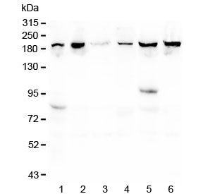 CPAMD8 / KIAA1283 Antibody - Western blot testing of human 1) placenta, 2) T-47D, 3) U-2 OS, 4) K562, 5) ThP-1 and 6) monkey COS-7 lysate with CPAMD8 antibody at 0.5ug/ml. Predicted molecular weight ~207 kDa.