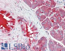 CPB / Carboxypeptidase B Antibody - Human Pancreas: Formalin-Fixed, Paraffin-Embedded (FFPE)
