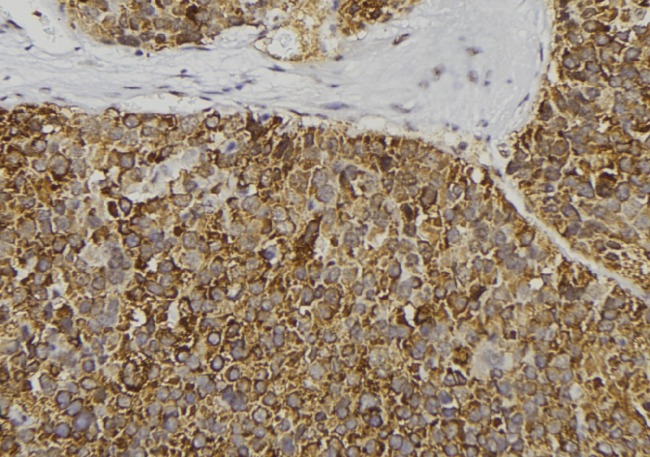 CPB / Carboxypeptidase B Antibody - 1:100 staining human pancreas tissue by IHC-P. The sample was formaldehyde fixed and a heat mediated antigen retrieval step in citrate buffer was performed. The sample was then blocked and incubated with the antibody for 1.5 hours at 22°C. An HRP conjugated goat anti-rabbit antibody was used as the secondary.