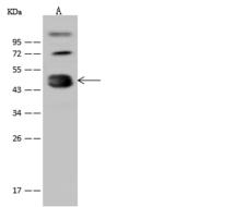 CPB / Carboxypeptidase B Antibody - Anti-CPB1 rabbit polyclonal antibody at 1:500 dilution. Lane A: Mouse spleen tissue lysate. Lysates/proteins at 30 ug per lane. Secondary: Goat Anti-Rabbit IgG (H+L)/HRP at 1/10000 dilution. Developed using the ECL technique. Performed under reducing conditions. Predicted band size: 47 kDa. Observed band size: 47 kDa.
