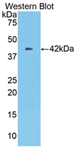 CPB2 / TAFI Antibody - Western Blot; Sample: Recombinant protein.