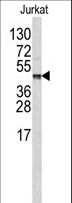 CPB2 / TAFI Antibody - Western blot of CPB2 antibody (Center E134) in Jurkat cell line lysates (35 ug/lane). CPB2 (arrow) was detected using the purified antibody.