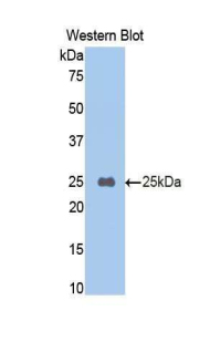 CPB2 / TAFI Antibody - Western blot of recombinant CPB2 / TAFI.  This image was taken for the unconjugated form of this product. Other forms have not been tested.