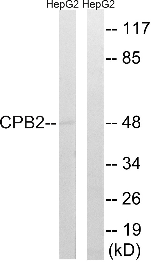 CPB2 / TAFI Antibody - Western blot analysis of lysates from HepG2 cells, using CPB2 Antibody. The lane on the right is blocked with the synthesized peptide.