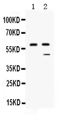 CPB2 / TAFI Antibody - Western blot - Anti-TAFI/CPB2 Picoband Antibody