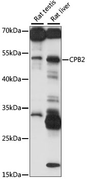 CPB2 / TAFI Antibody - Western blot analysis of extracts of various cell lines, using CPB2 antibody at 1:1000 dilution. The secondary antibody used was an HRP Goat Anti-Rabbit IgG (H+L) at 1:10000 dilution. Lysates were loaded 25ug per lane and 3% nonfat dry milk in TBST was used for blocking. An ECL Kit was used for detection and the exposure time was 10S.