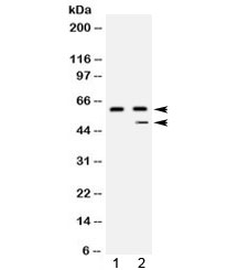 CPB2 / TAFI Antibody - Western blot testing of 1) human placenta and 2) HepG2 lysate with Carboxypeptidase B2 antibody at 0.5ug/ml. Predicted molecular weight: ~48 kDa but routinely observed at 50-60 kDa.